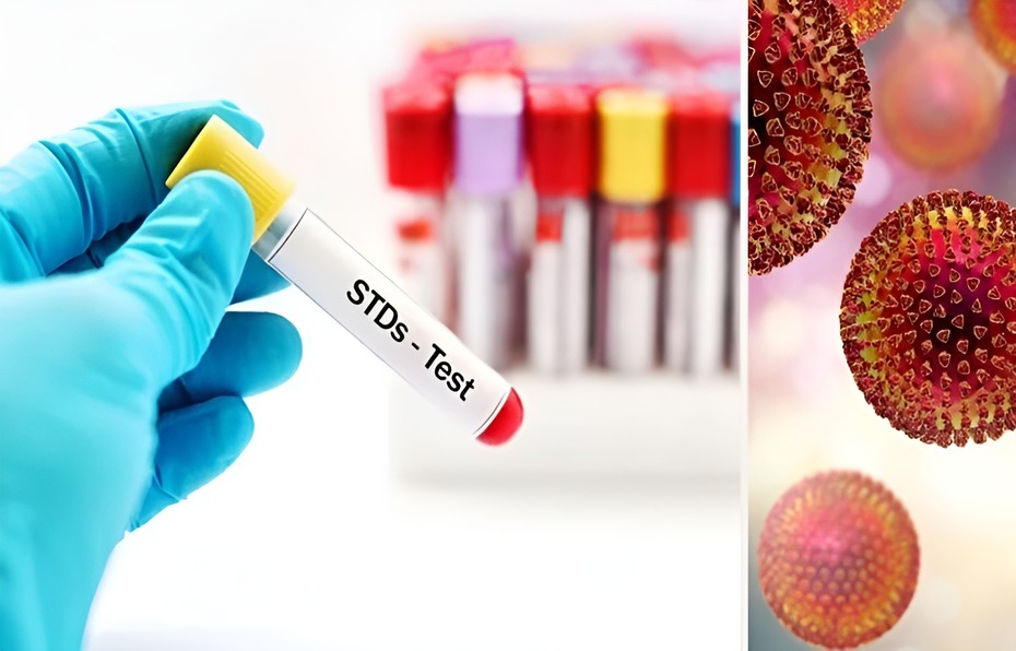 std-testing-and-treatment(1)